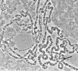 Phase-contrast microscopy image of Drosophila melanogaster polytene chromosomes from larval salivary glands. The image shows several thick, banded chromosomal arms radiating outward from a central chromocentre, where the heterochromatic regions of all chromosomes fuse. The distinct dark and light transverse banding pattern along each arm is clearly visible and was used by early geneticists to map gene and inversion positions.